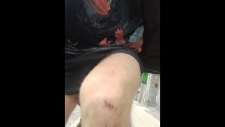 公众敢于-用担架闪烁睾丸