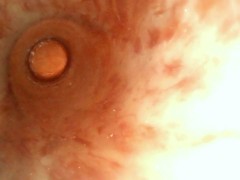Endoscope inside 9mm tube estim urethra to prostate orgasm ejaculation full length