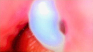 Endoscope Camera Inside My Pink Pussy Records How He Fills Me With Cum💎 - Couple Keyla & Lucas