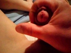 Masturbe (313) with one testicle