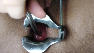 FTM Cervix Sondage Clip