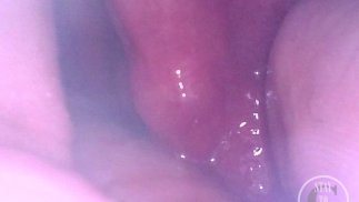 POV Fisting filmed from deep inside my Ass - Preview
