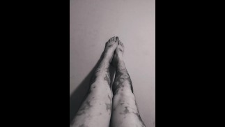 I love my moles. My partner almost saw me