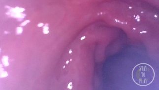 POV Extreme Deep Anal Examination 📷🍑 - Preview