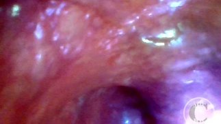 POV Extrem Tiefe Anal Erforschung! Sichtbarer Herzschlag - Vorschau