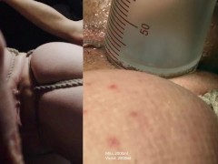 The Blindfolded Enema Race Part 2 of 3