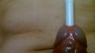 Urethral insertion with pen