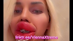 Самые экстремально опухшие губы с искусственным ботоксом на публике | Vienna Xtreme
