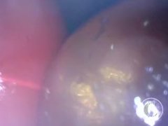 📷 INSIDE ASS POV: The Eggs disappeared in the hole ... 🍑 - Preview - Screenshot 10 of 16 - Gape