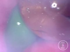 📷 INSIDE ASS POV: The Eggs disappeared in the hole ... 🍑 - Preview - Screenshot 13 of 16 - Alien Eggs