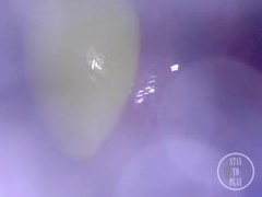 📷 INSIDE ASS POV: The Eggs disappeared in the hole ... 🍑 - Preview - Screenshot 4 of 16 - Anal Gape