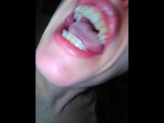 You Said You Couldn't Take My Kindness Freestyle Ugly Girl Fucked up Teeth Singing Onlyfans Whore OF