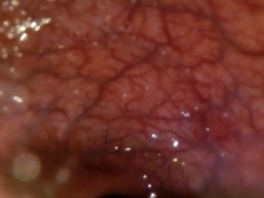 POV: Gulping you into the tip of my transverse