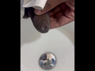 Foreskin Pissaing