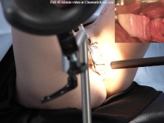 Wendy Wonder embarrassed at the gynecologist 15/16