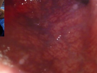 从外面向你扑来