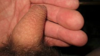 My hairy tiny dick with one testicle