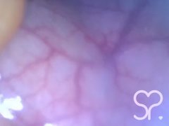 Anal Endoscope all the way in my Transverse Colon - Full Video on Manyvids and Fansly