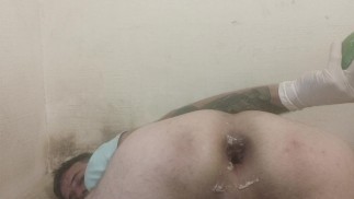 Garrafa anal