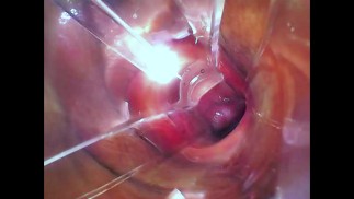 Deep in the pussy. Crem's search. 4 k