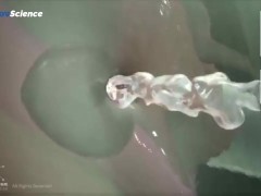 Анатомия 3D Женская анатомия - Что находится внутри ?Женская предстательная железа от издания Dandel