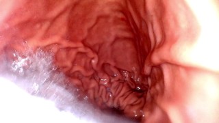Free Endoscope Vore Porn Videos from Thumbzilla