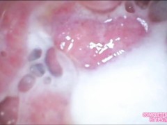 MgirlTV - Camera deep inside 20yo teen creamy pussy