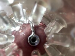 Super camera. Cumming in pussy from a catheter - Screenshot 1 of 16 - Endoscope