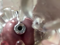 Super camera. Cumming in pussy from a catheter - Screenshot 11 of 16 - Endoscope