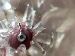Super camera. Cumming in pussy from a catheter - Screenshot 15 of 16 - Sperm Pussy