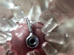 Super camera. Cumming in pussy from a catheter - Screenshot 2 of 16 - Close Up