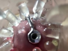 Super camera. Cumming in pussy from a catheter - Screenshot 5 of 16 - Sperm Pussy