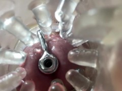 Super camera. Cumming in pussy from a catheter - Screenshot 6 of 16 - Endoscope