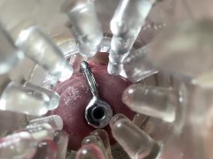 Super camera. Cumming in pussy from a catheter - Screenshot 7 of 16 - Close Up