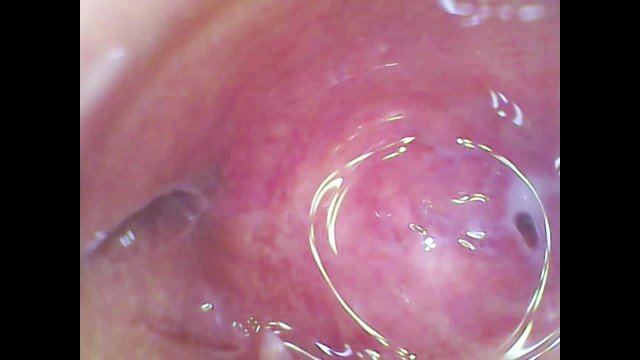 Real pussy orgasm contraction cam inside the pussy! Sperm found in pussy juice under microscope!!!