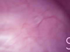 Fucked in my Ass + Camera in my Bladder = Crazy Bulge! - Full Video on Manyvids and Fansly