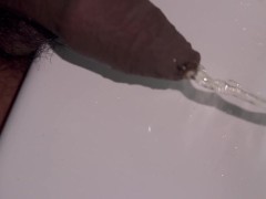 Foreskinpiss