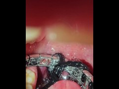 I swallows my bracelet and heart-shaped earring