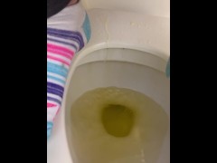 Messy toilet seat piss