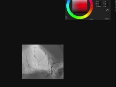 春、つぼみが開く - Screenshot 2 of 16 - Big Ass