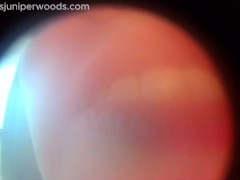 Fisheye Lens Mouth Tour Vore