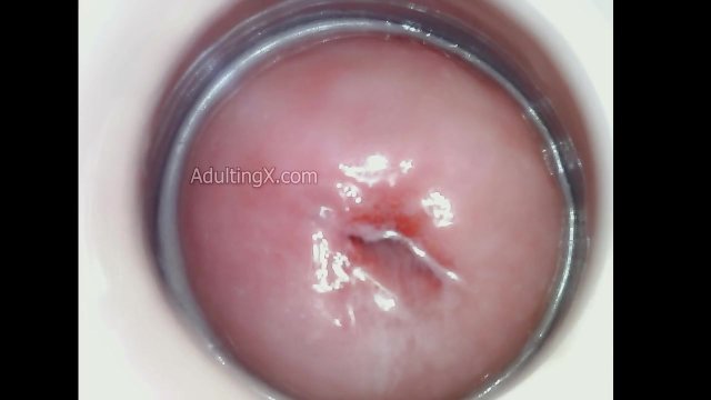 Horny Juicy Cervix