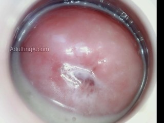 Creamy Cervix