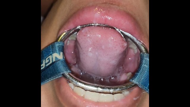 Putting it in her pussy and then straight into her mouth with a spider gag in her open mouth05/10/25