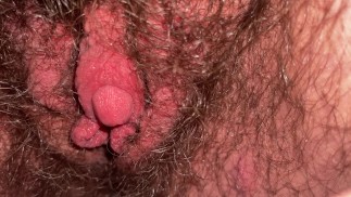 Thumbnail ftm my swollen clit after hours of edging