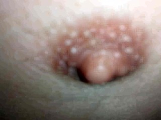 My Body (1) with one Testicle
