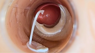 Kamera in tiefer Muschi fängt riesigen Sperma-Ausstoß ein