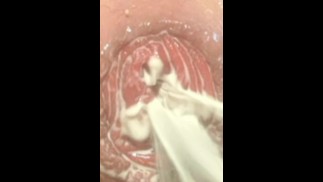 Big anal dildo ride by hot boy whit milk anal prolapse.