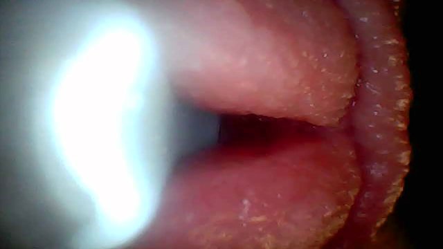 Endoscope camera shows the most sensitive parts of the penis Educational video