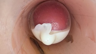 奥深くに挿入されたカメラがコンドームの中に大量の精子を射精する様子を録画する